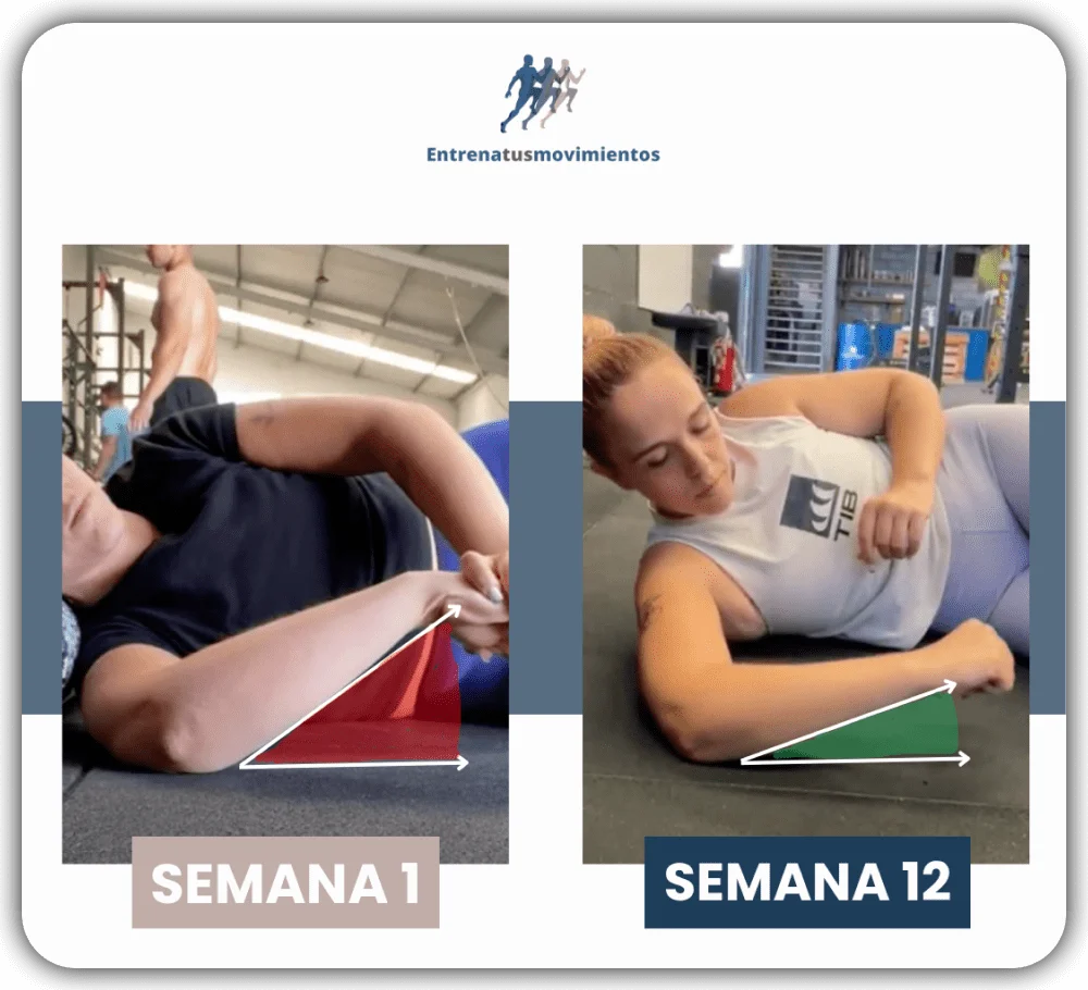 Antes y después — caso 1