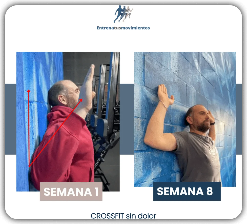 Antes y después — caso 10