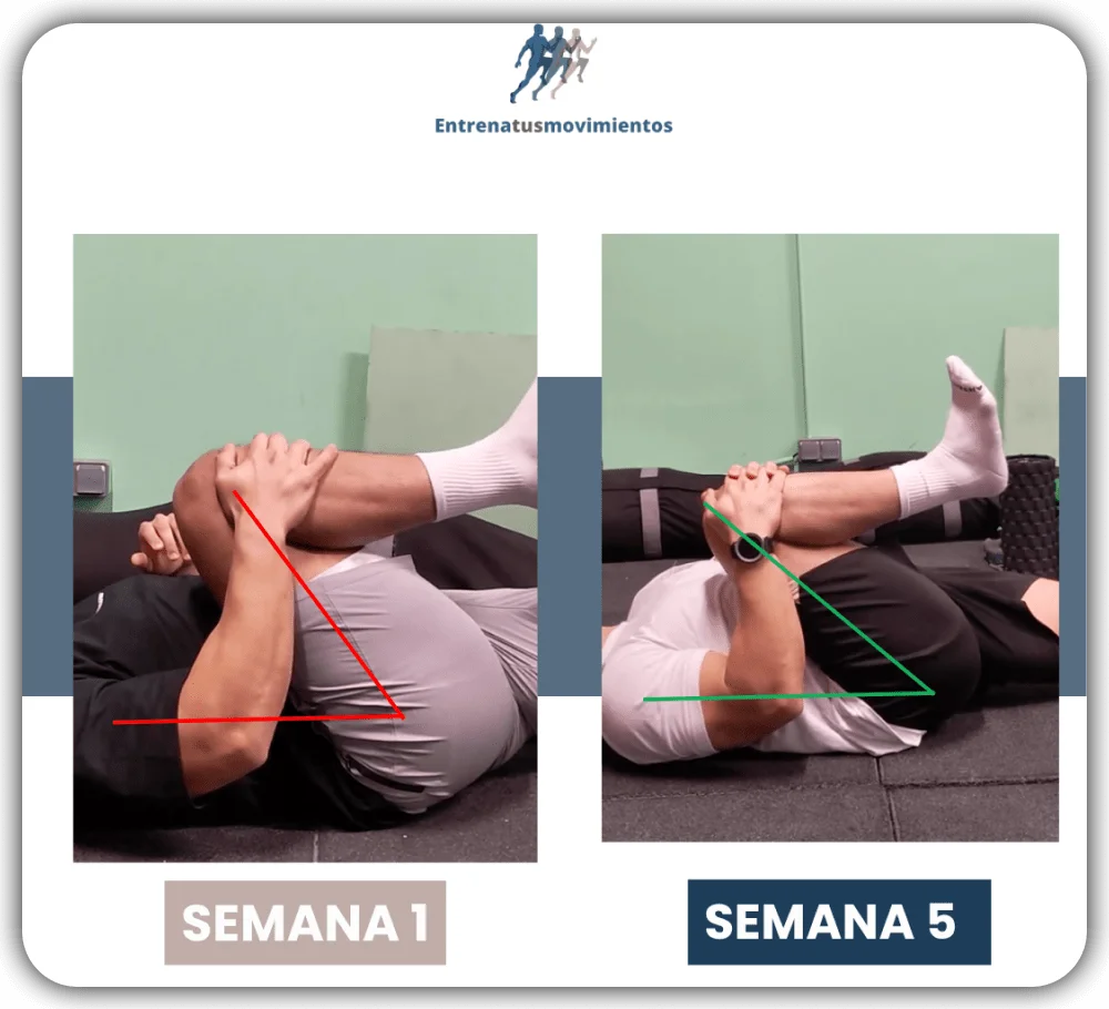 Antes y después — caso 11