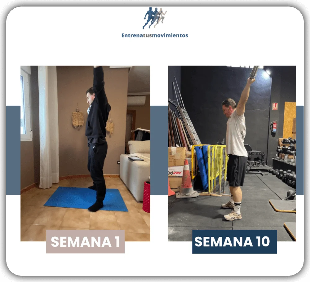 Antes y después — caso 13