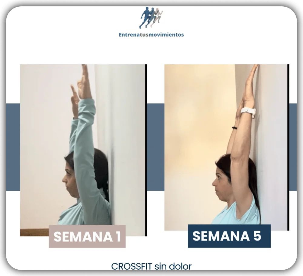 Antes y después — caso 17