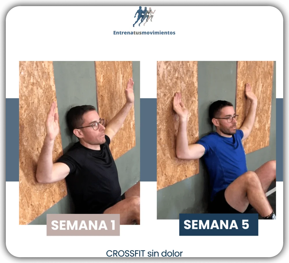 Antes y después — caso 18