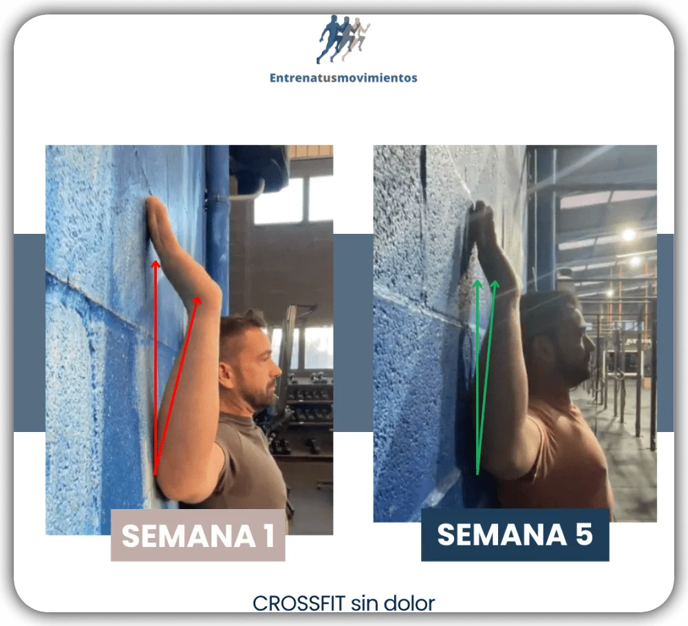 Antes y después — caso 4