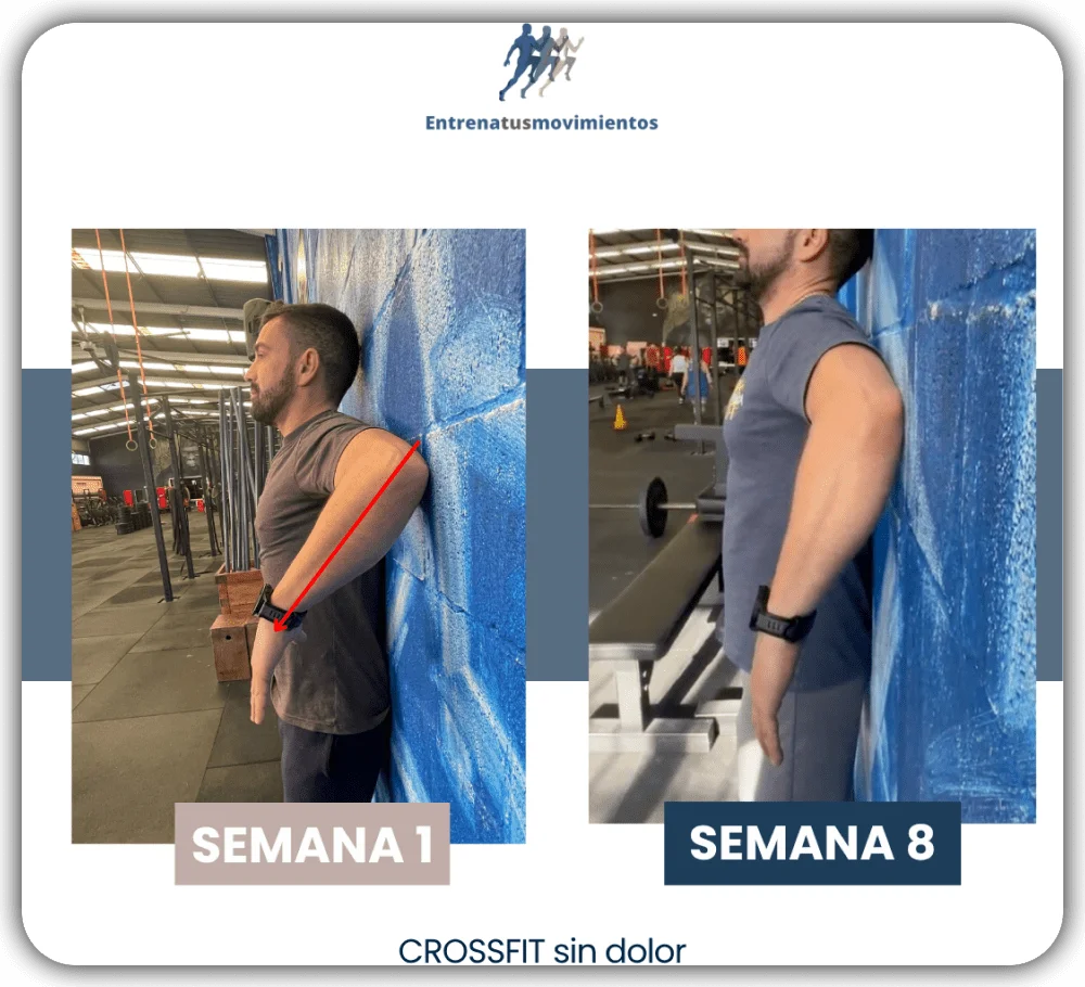 Antes y después — caso 5