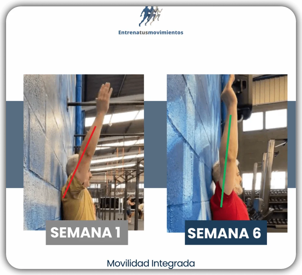 Antes y después — caso 9